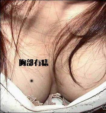 手背有痣则表示你颇善于理财
