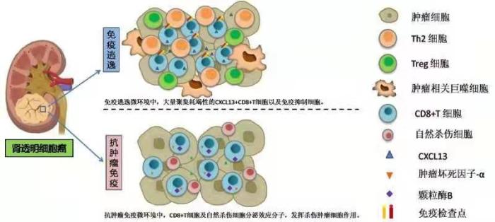 中国专家率先发现肾透明细胞癌免疫逃逸的关键性“元凶”