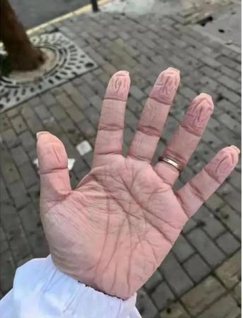 心疼！这是29岁社区医生采完核酸后的手