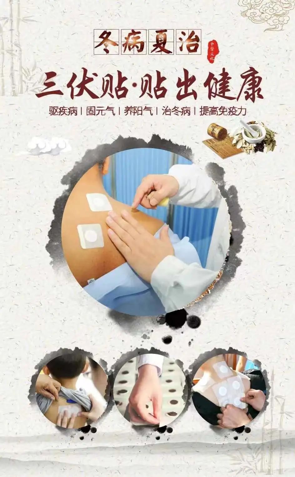 一年一度三伏贴，冬病夏治正当时